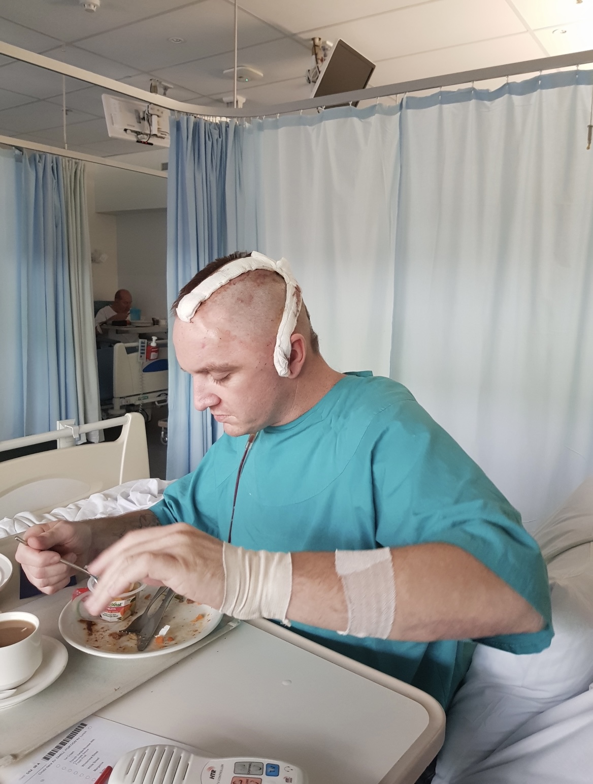 A young man, Jason, sits on a hospital bed eating hospital food in a hospital gown. He has a half shaved head where injuries to his head have been operated on. He has bandages on his arms.
